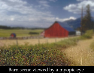 Myopic Vision