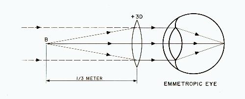 Plus Lens