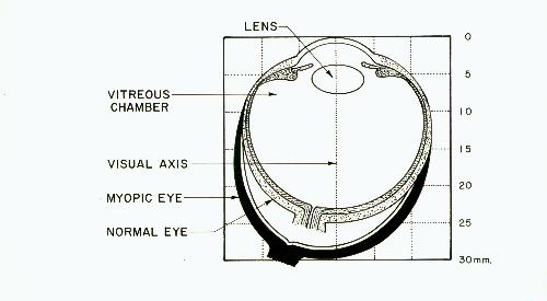 Stretched eye