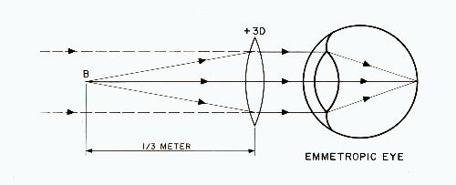 Plus lens